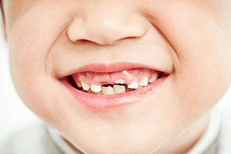 孩子开始长牙,该如何护理牙齿?5种情况分别对待