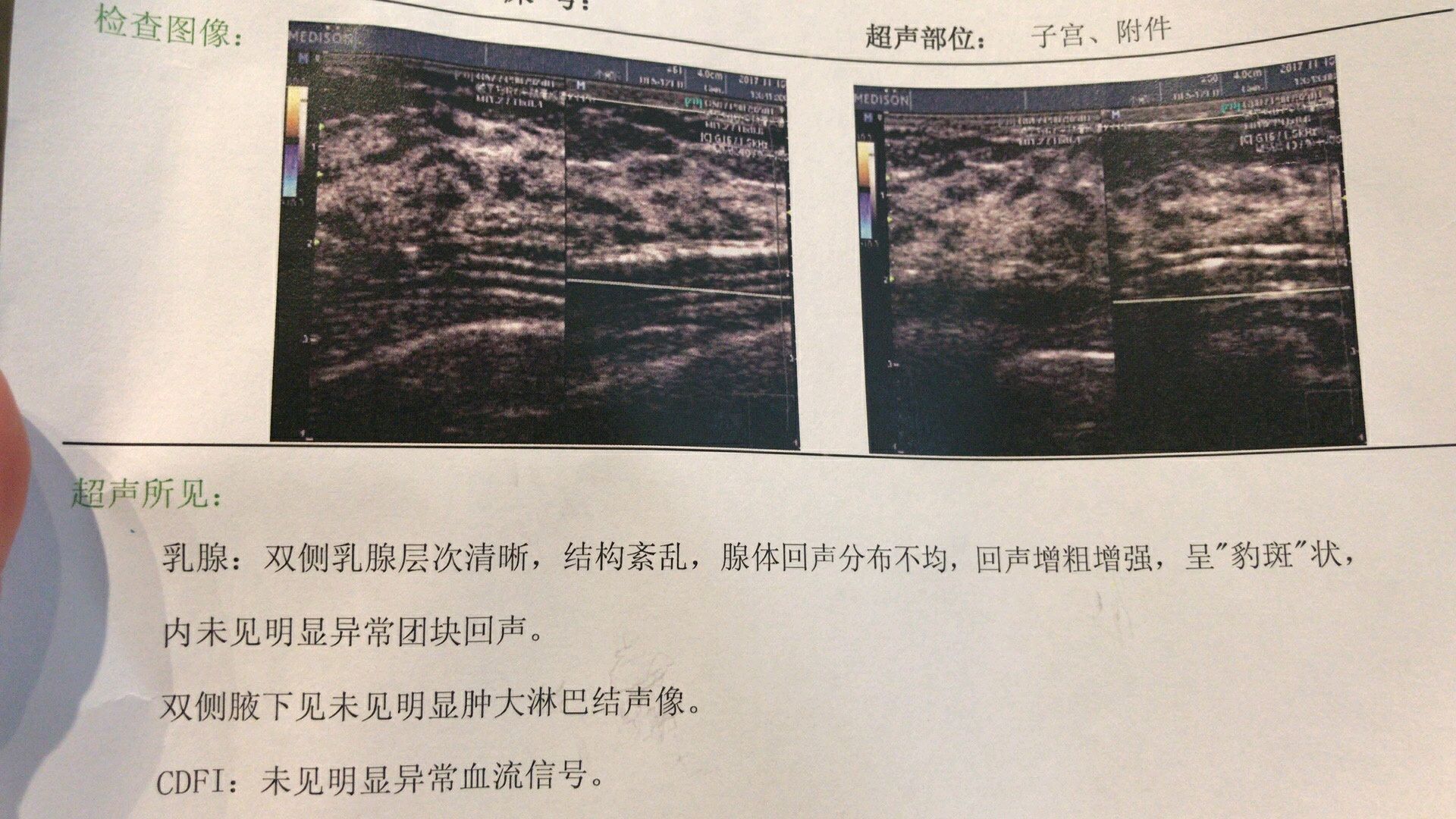 擅长：妇科疾病与泌尿生殖系统疾病诊断、骨科疾病及骨肿瘤诊断、胞病理学诊断。黄牛挂号，服务至上诚信第一的简单介绍