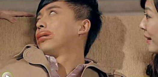 (图为大家都知道的海鲜过敏代言人-张伟)