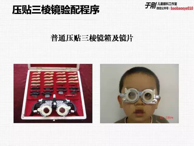很多家长咨询三棱镜治疗儿童斜视的问题,今天于刚主任,吴倩主任给家长