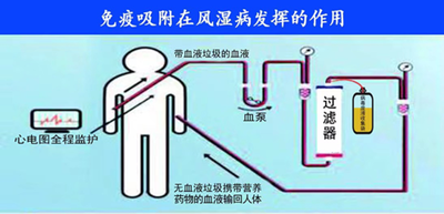 類風溼患者如何調免疫記住這2個方法