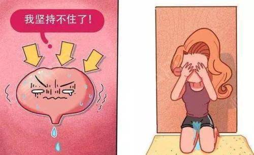 年轻女性咳嗽漏尿,压力性尿失禁如何治疗?-李旭东副主任医师-爱问医生