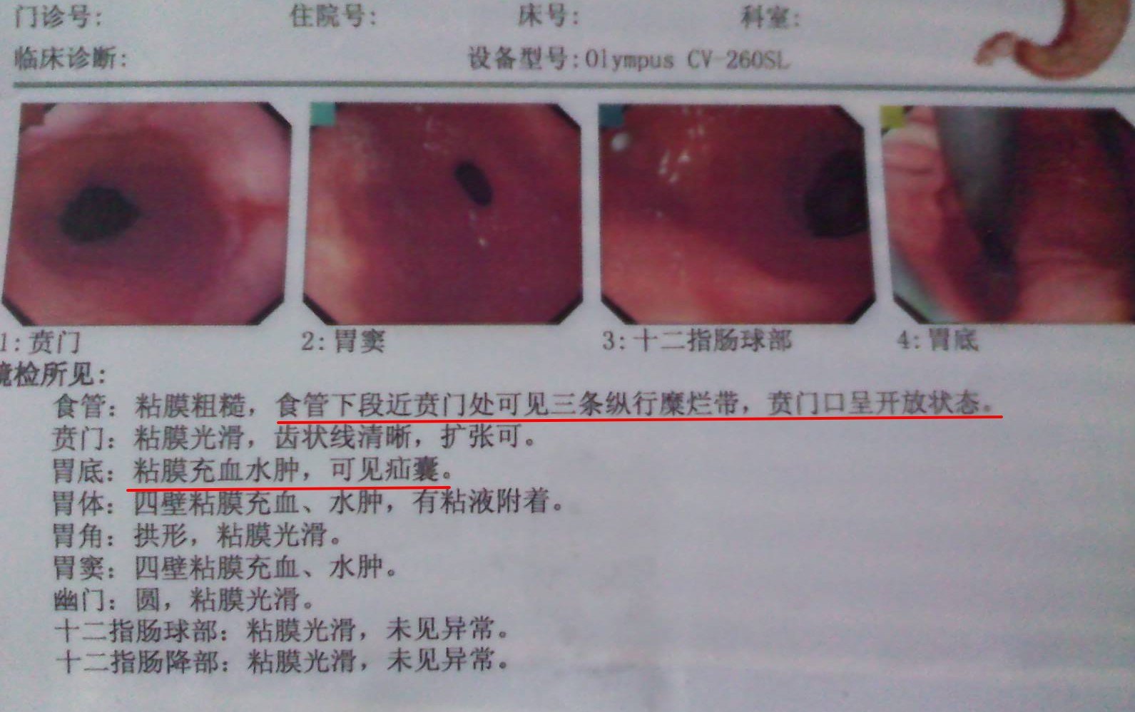 胃什么叫胃食管反流    管晓勇副主任医师为您科普消化内科芜湖广济