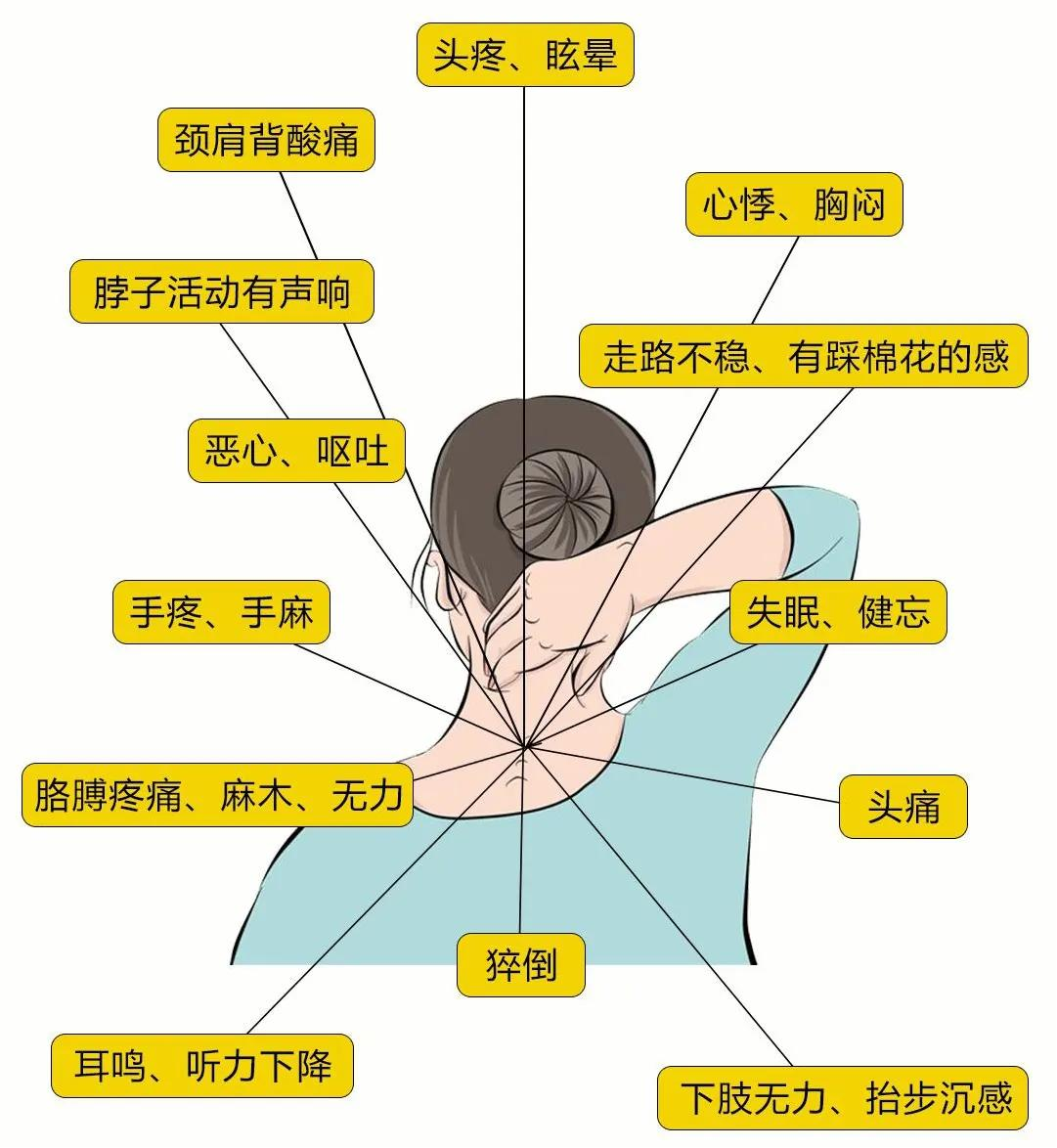 颈椎左前斜位置示意图图片